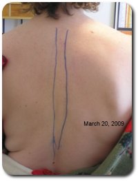 March 20 before